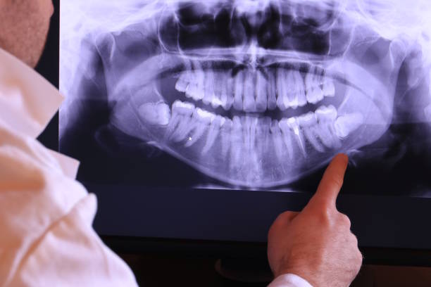 Best Emergency Root Canal Therapy in Olton, TX
