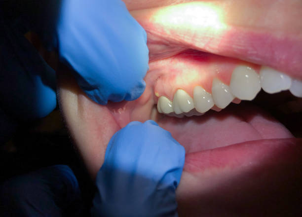 Best Emergency Cosmetic Dentistry (e.g., broken veneers) in Olton, TX
